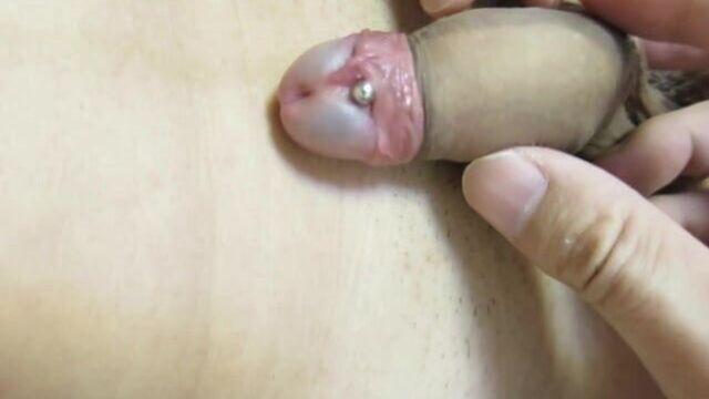 To prevent paraphimosis (tightened foreskin days after)